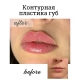 Контурная пластика губ